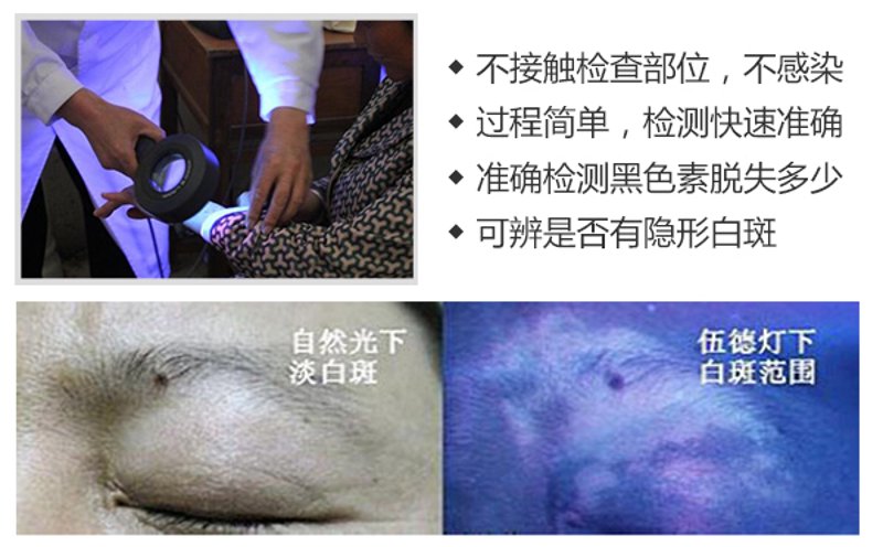 医保定点白癜风医院：开启希望之门
