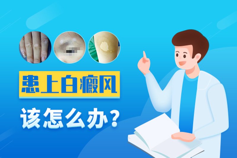 最新白癜风治疗进展与方法解析